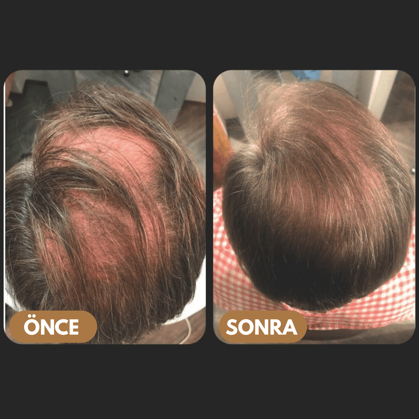 MELUSCA™ Saç Dökülmesine Karşı Kök Aktifleştirici Şampuan