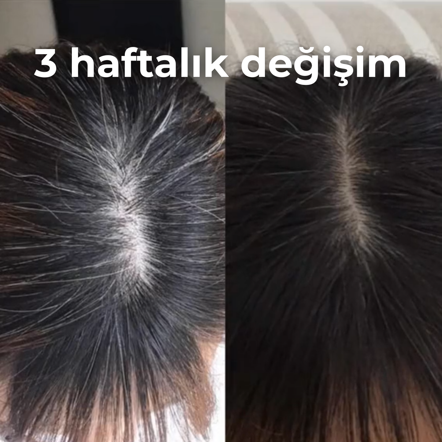 Saç Beyazlama Karşıtı Doğal Sabun