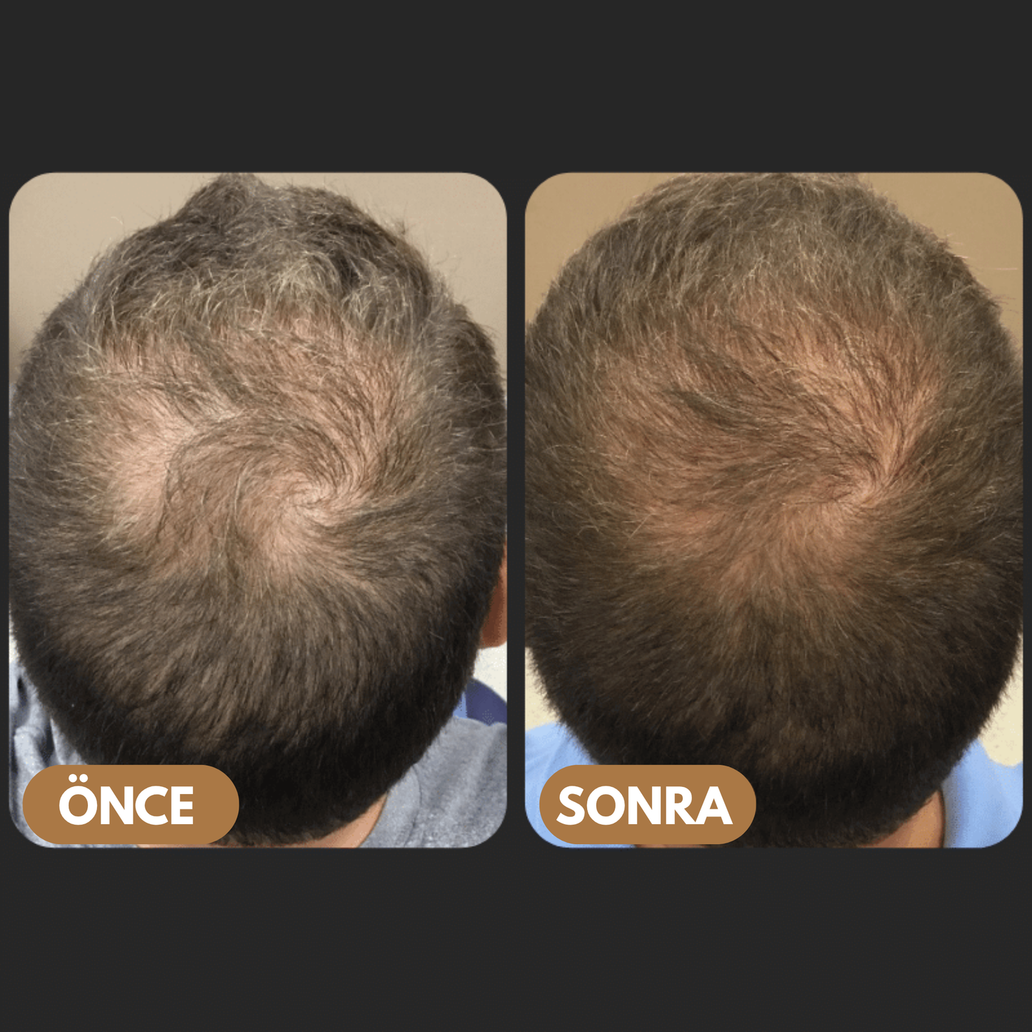 MELUSCA™ Saç Dökülmesine Karşı Kök Aktifleştirici Şampuan