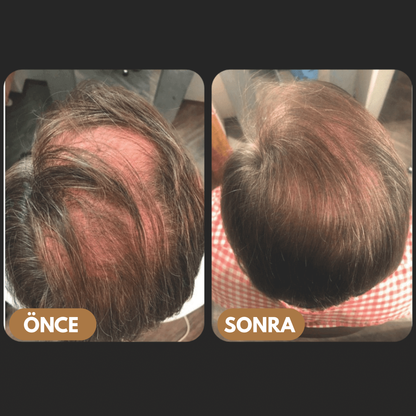 MELUSCA™ Saç Dökülmesine Karşı Kök Aktifleştirici Şampuan