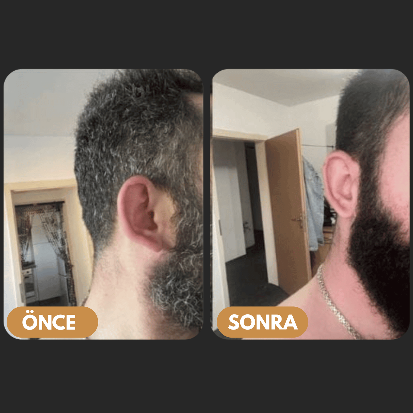 Saç Beyazlama Karşıtı Doğal Sabun