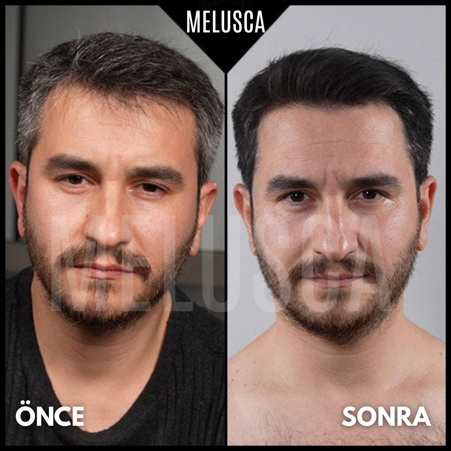 Saç Beyazlama Karşıtı Doğal Sabun