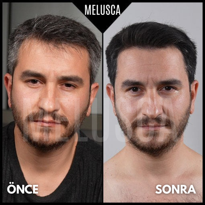 Saç Beyazlama Karşıtı Doğal Sabun