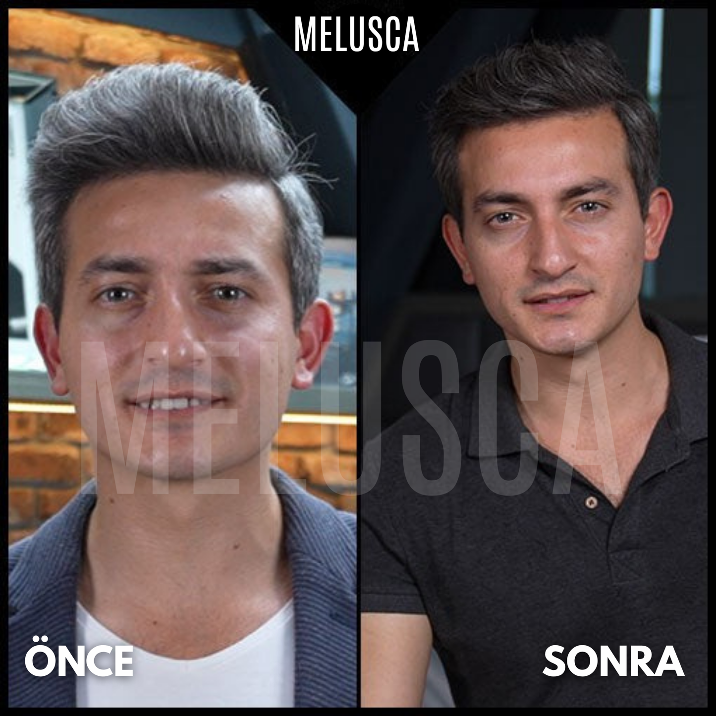 Saç Beyazlama Karşıtı Doğal Sabun
